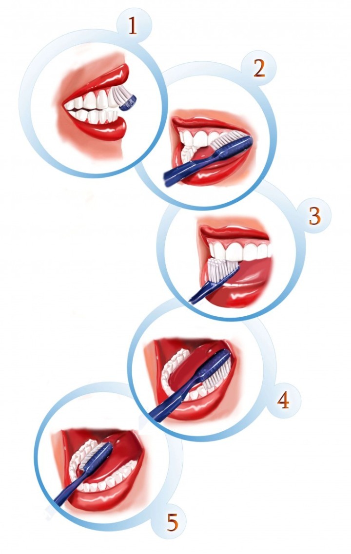 glenwood-dental-care-teeth-brushing.jpg