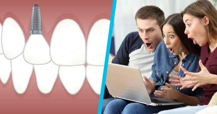 Опровергаем мифы о зубных имплантах