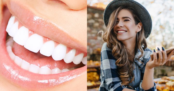 5 вещей, которые нужно знать о зубных имплантатах