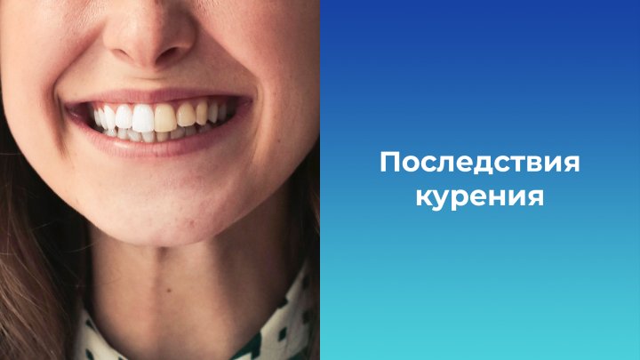 Титульное изображение статьи