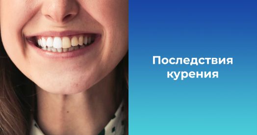 Насколько в действительности курение влияет на здоровье полости рта?